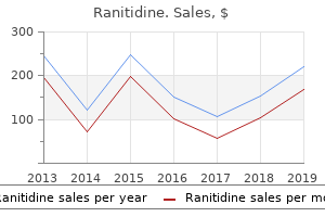 buy cheap ranitidine 300 mg