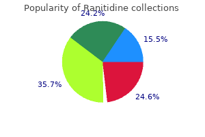 300 mg ranitidine