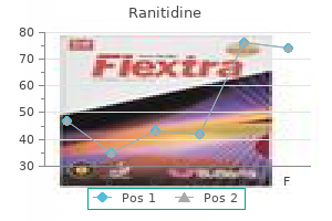 150mg ranitidine otc