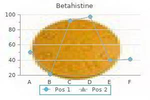 cheap 16 mg betahistine with amex