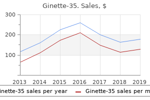 buy ginette-35 on line amex
