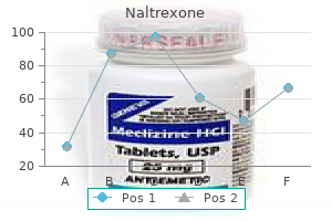 order naltrexone 50 mg visa